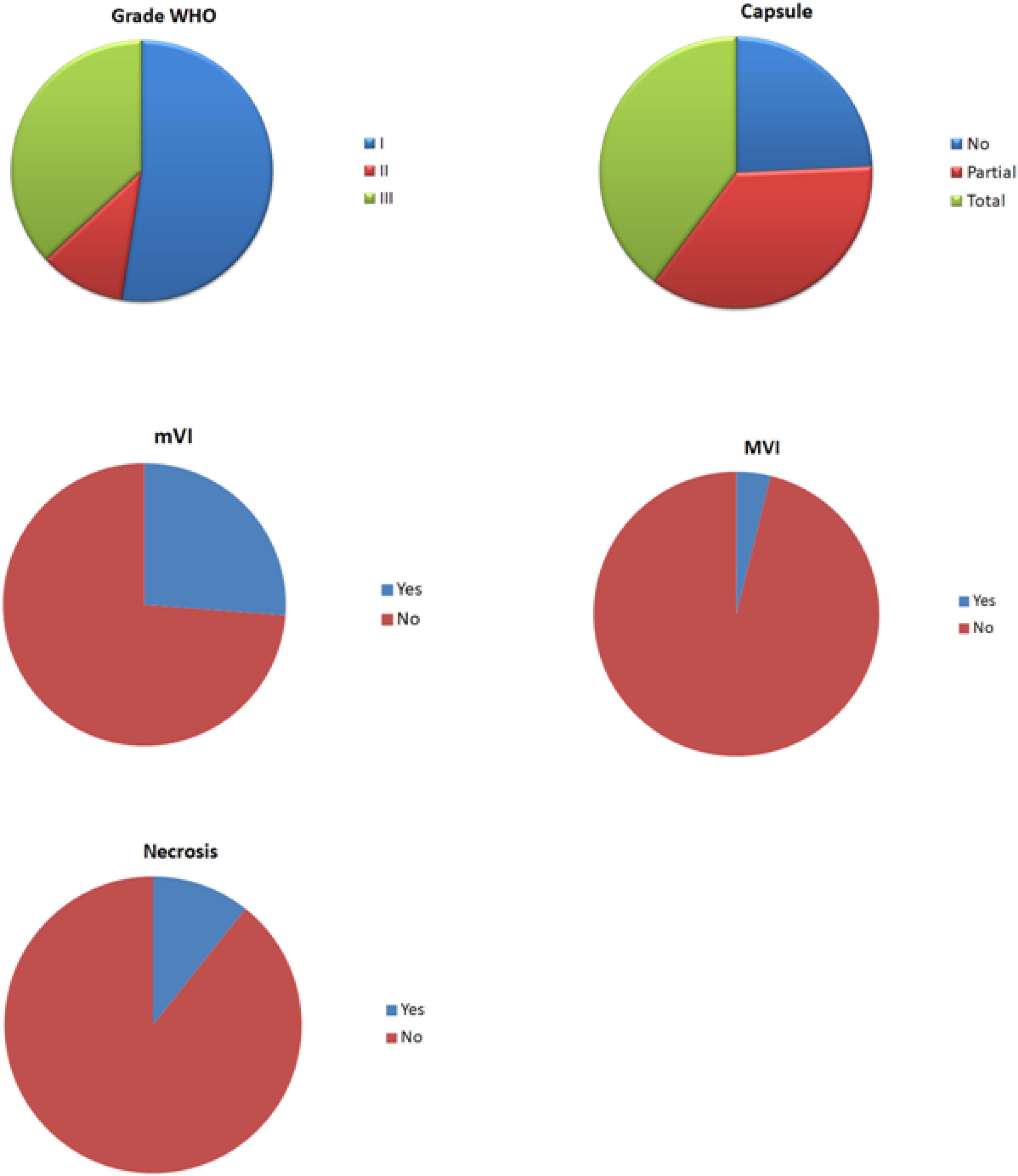 Influence of key histological characteristics on 18F-fluorodeoxyglucose /18F-choline positron emission tomography positivity in hepatocellular carcinoma: A machine learning study